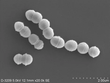 Group A hemolytic streptococcus bacteria 