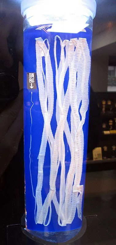 Specimens of a tapeworm