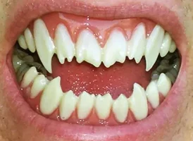 shark.webp