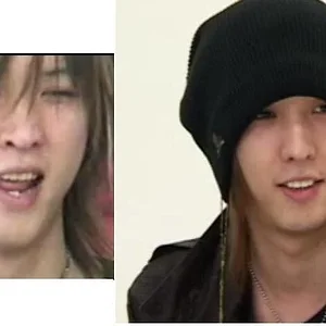 Ruka-dents.jpg