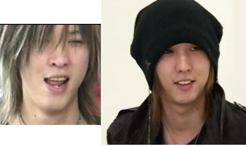 Ruka-dents.jpg